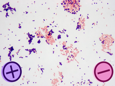 Image result for gram staining